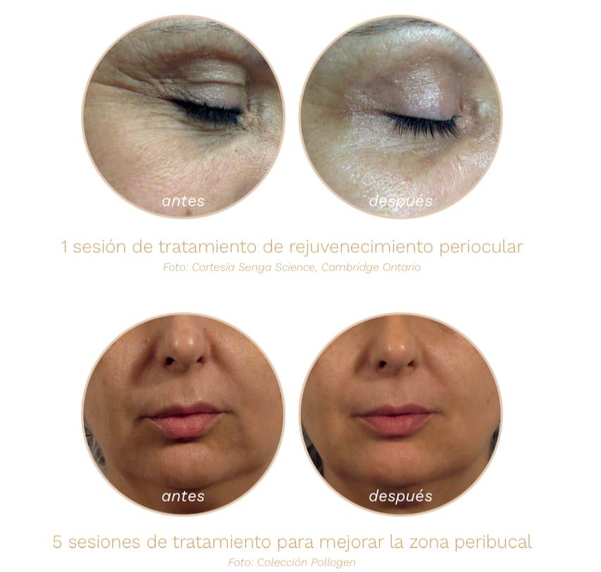 Detalle del tratamiento de tratamientos faciales